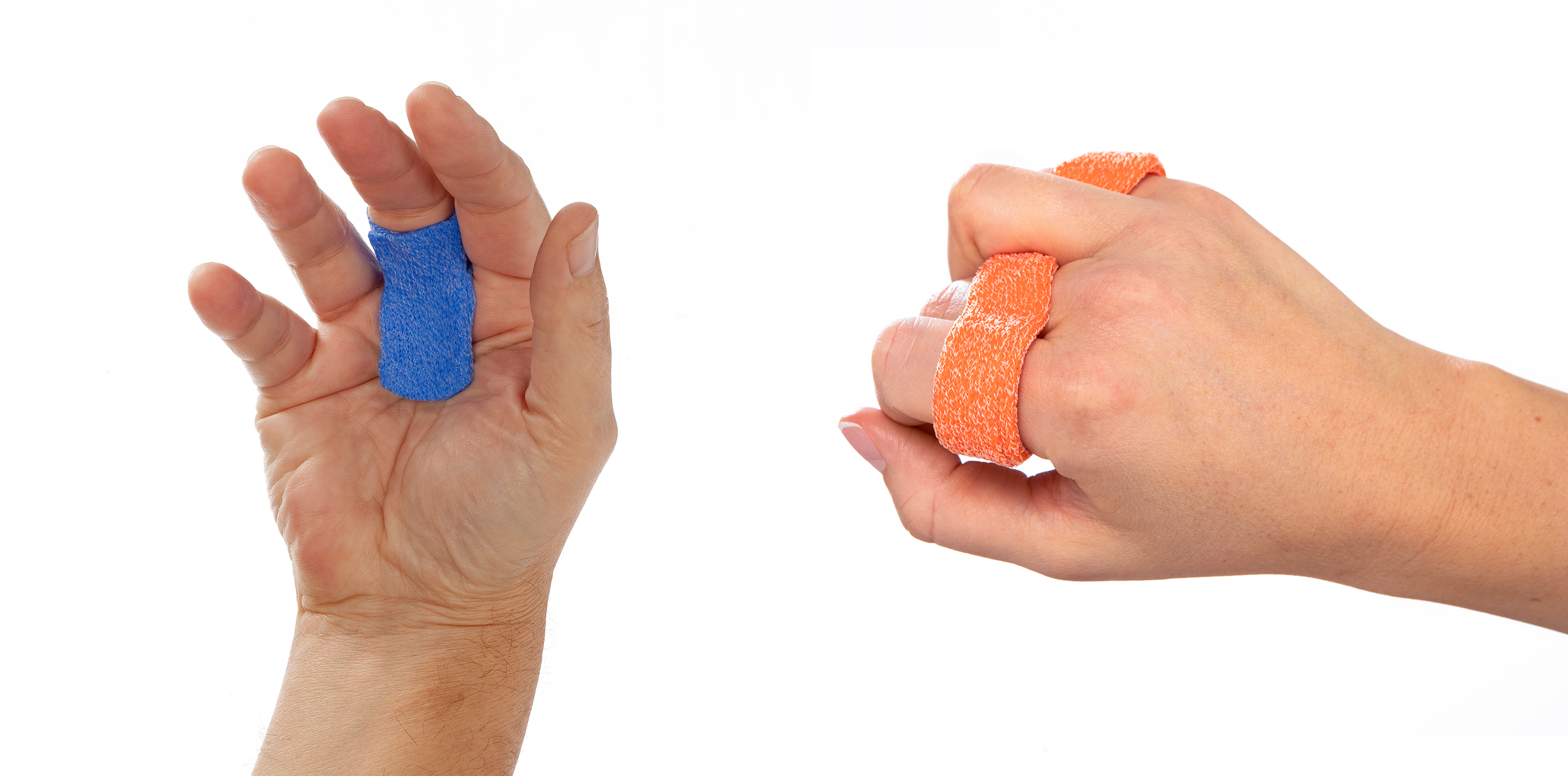 Blocking, Shifting, or Both? A Fresh Look at Orthotic Options for Trigger Finger