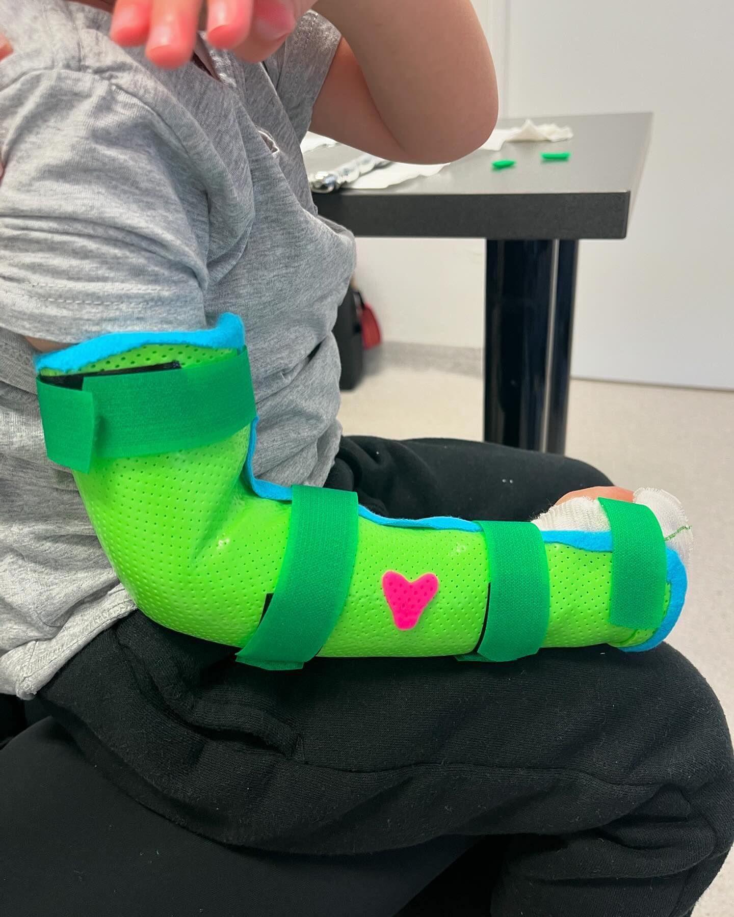 Orthotic fabrication for kids