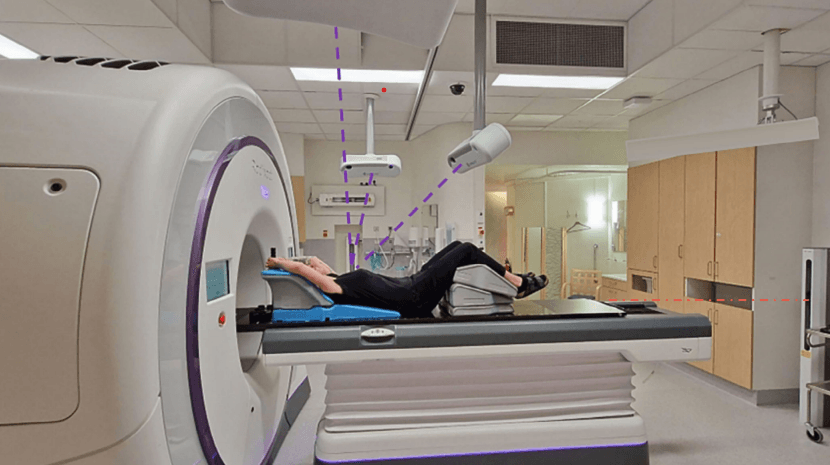 Study: Surface Guided Ring Gantry Radiotherapy